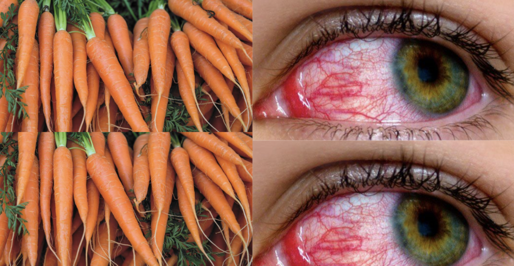 home remedy for pink eye