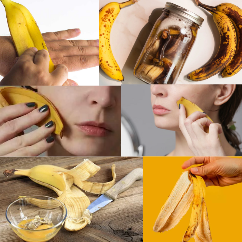 banana peel benefits