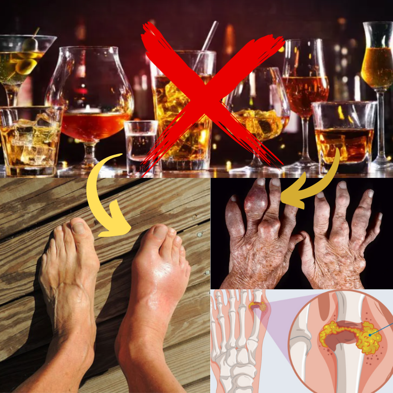 how to reduce gout