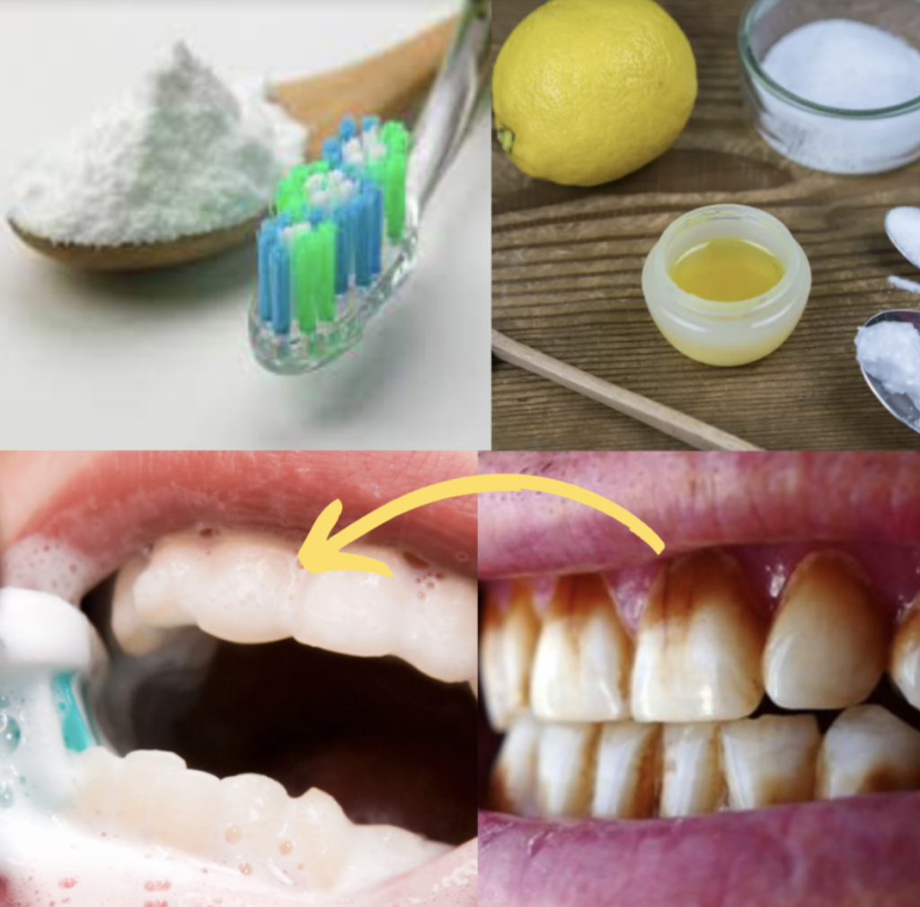 baking soda and lemon for teeth