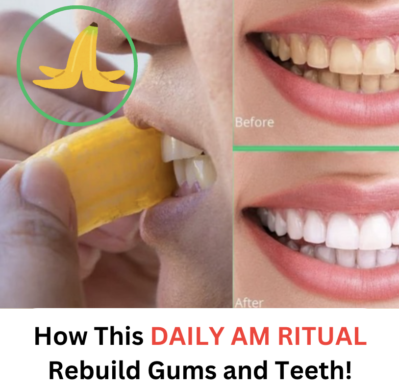 how to rebuild gum and teeth