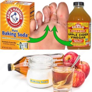 toe fungus remedies