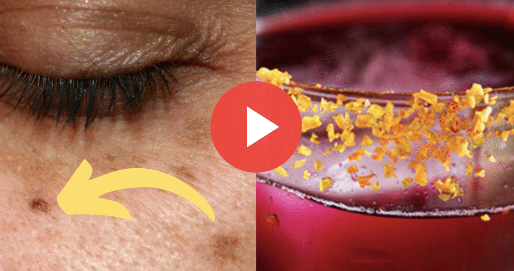 dark spots on skin